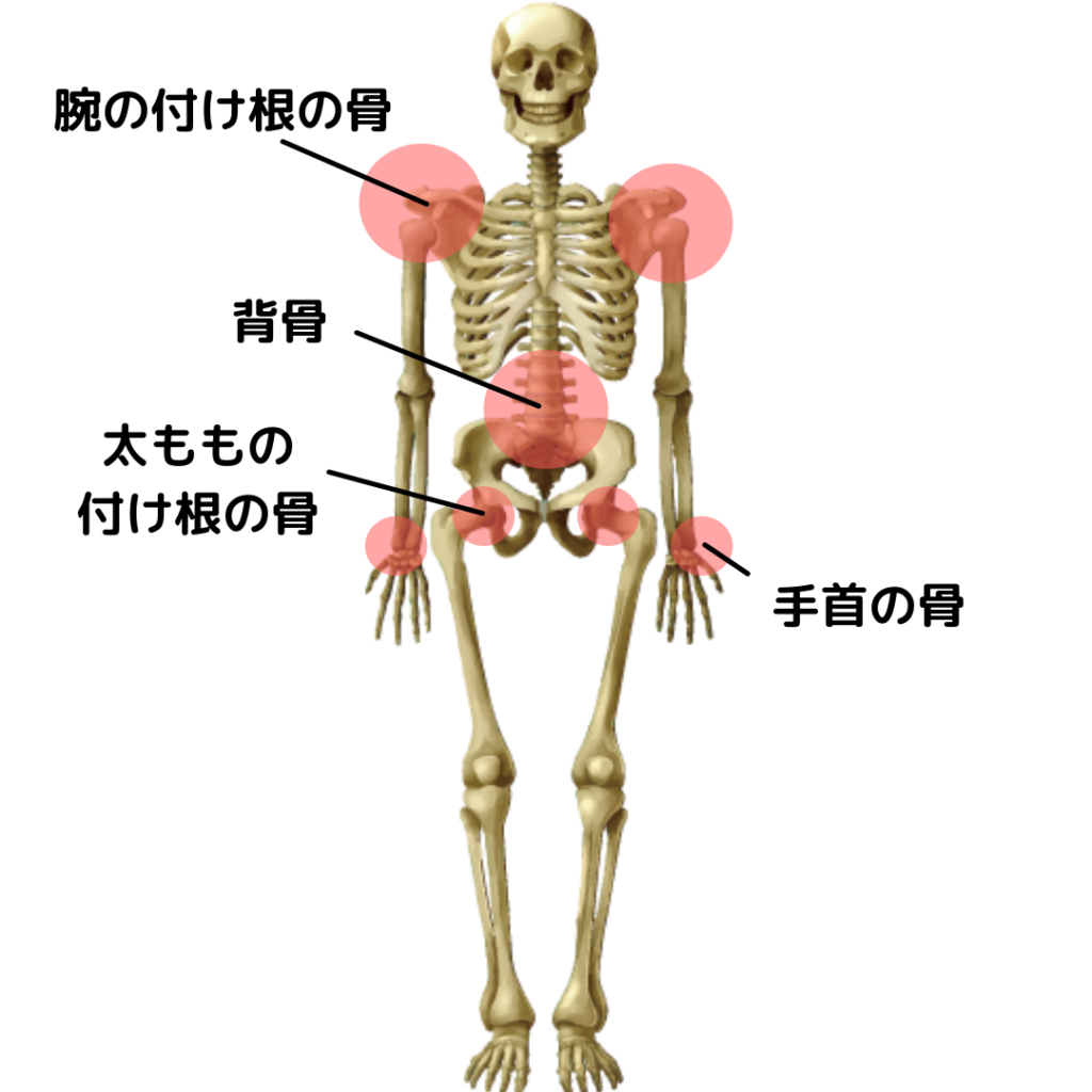 骨粗しょう症 骨粗鬆症 の原因や症状 治療から予防まで解説 ひまわり医院 内科 皮膚科