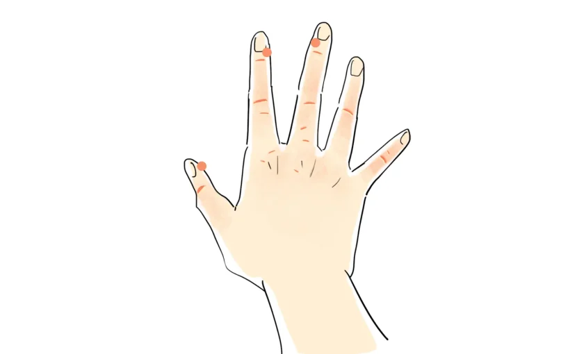 水いぼはうつる 水いぼ 伝染性軟属腫 の症状や治療 日常のケアについて ひまわり医院 内科 皮膚科