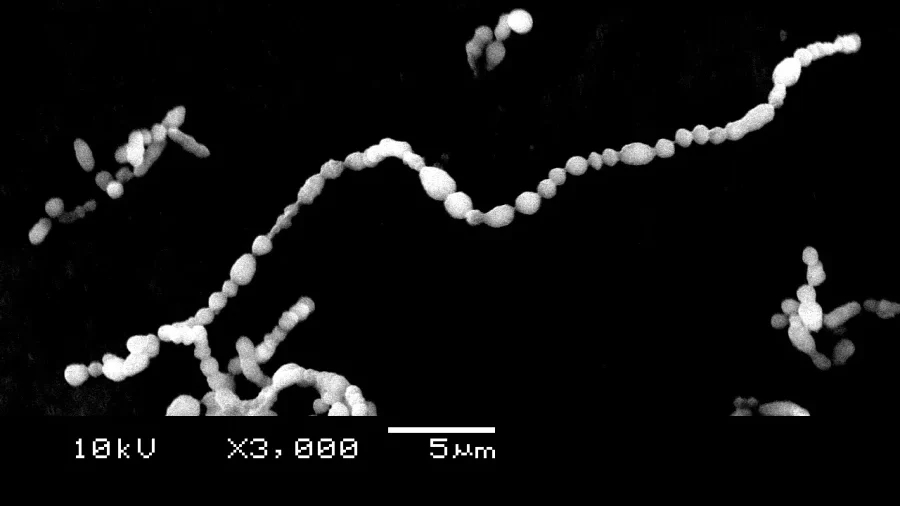 溶連菌の電子顕微鏡写真