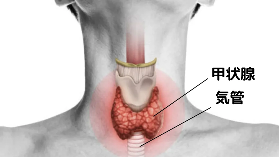 甲状腺の位置について。甲状腺は気管にはりつくようにあり、甲状腺炎でものどの痛みとして訴えることが多い。