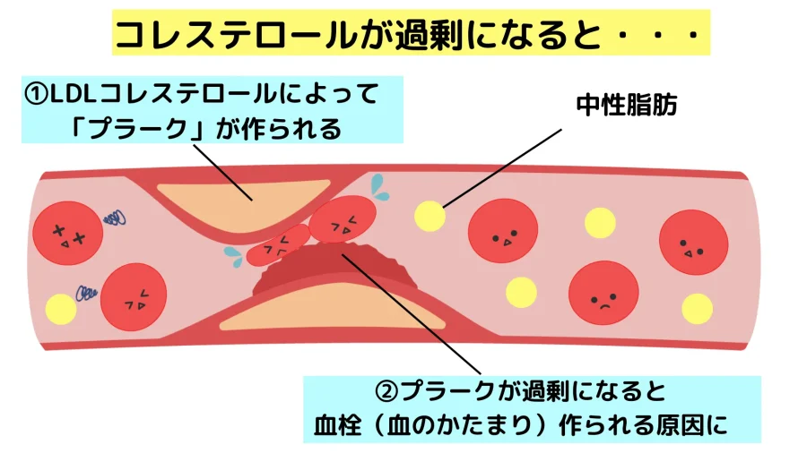 コレステロールを下げる方法