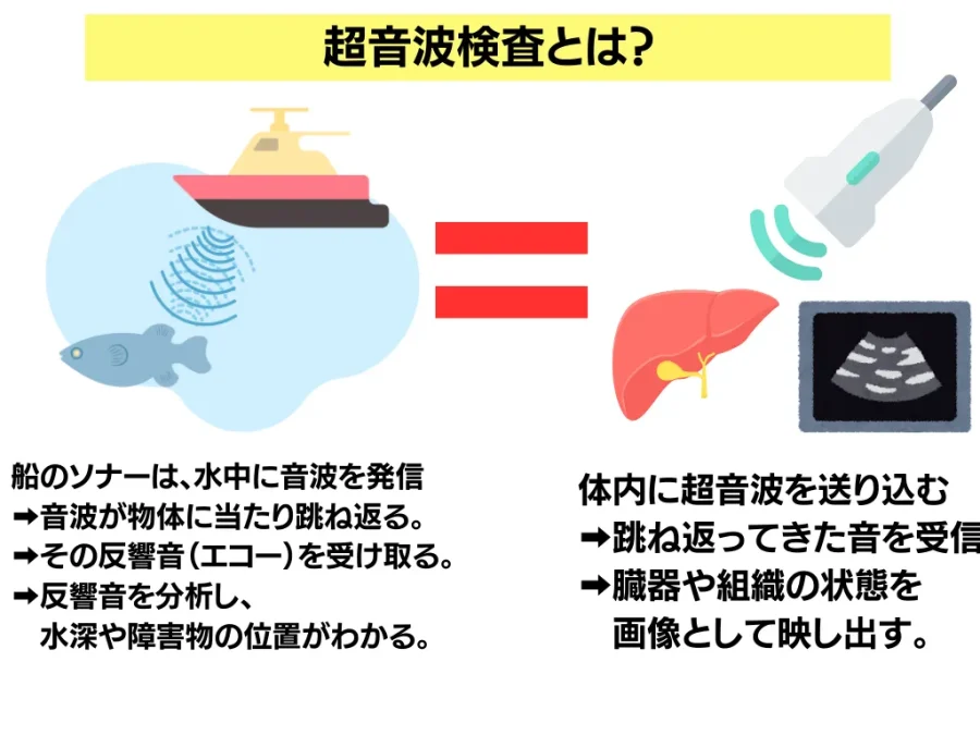 超音波検査（エコー検査）で何がわかる？検査の費用やわかる病名 