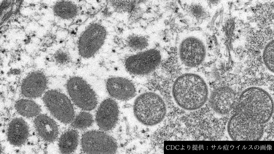 サル痘の電子顕微鏡写真