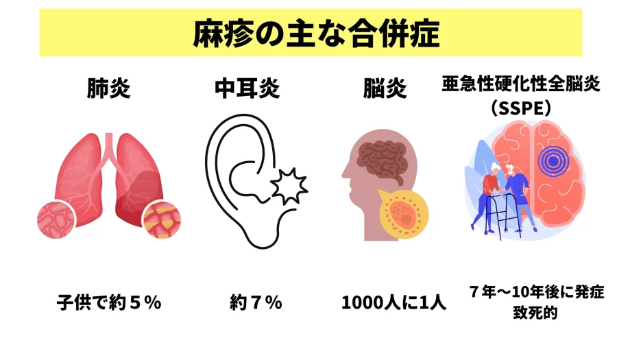 麻疹について 厚生労働省 | 麻疹 はしか ワクチン – YCQRE