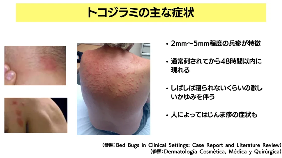 エッセンシャルオイルを配合したシラミ予防スプレーは効果がありますか?