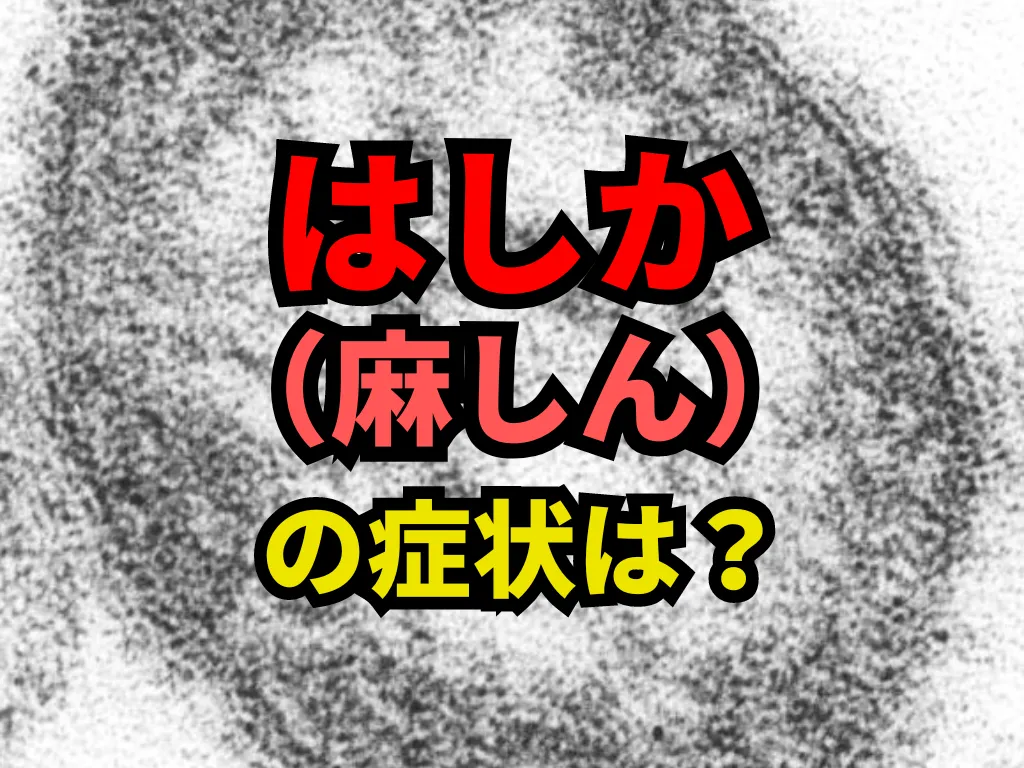 はしか（麻しん）の症状と風疹との違いについて解説 | ひまわり医院（内科・皮膚科）