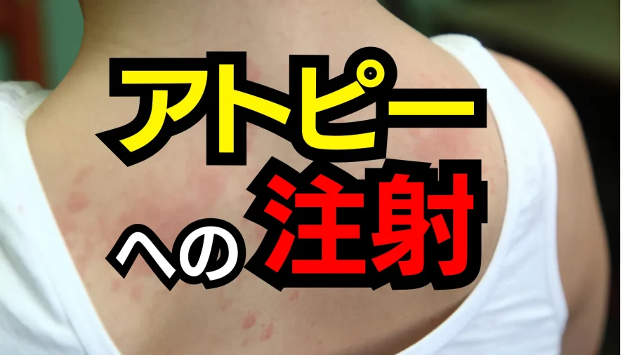 アトピー性皮膚炎の注射、最新治療ガイド！効果や費用、気になる副作用